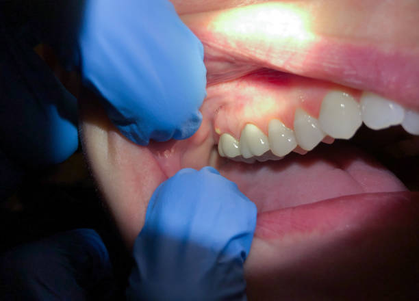 Best Emergency Treatment for Toothache in Caldwell, NJ